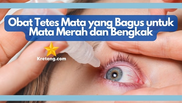 Obat Tetes Mata yang Bagus untuk Mata Merah dan Bengkak