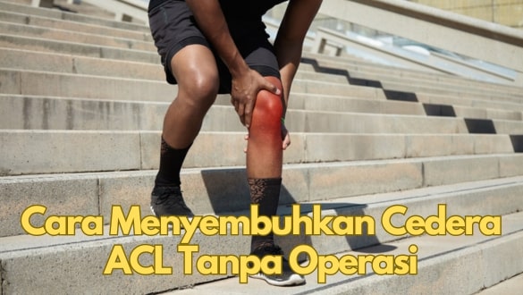 Cara Menyembuhkan Cedera ACL Tanpa Operasi